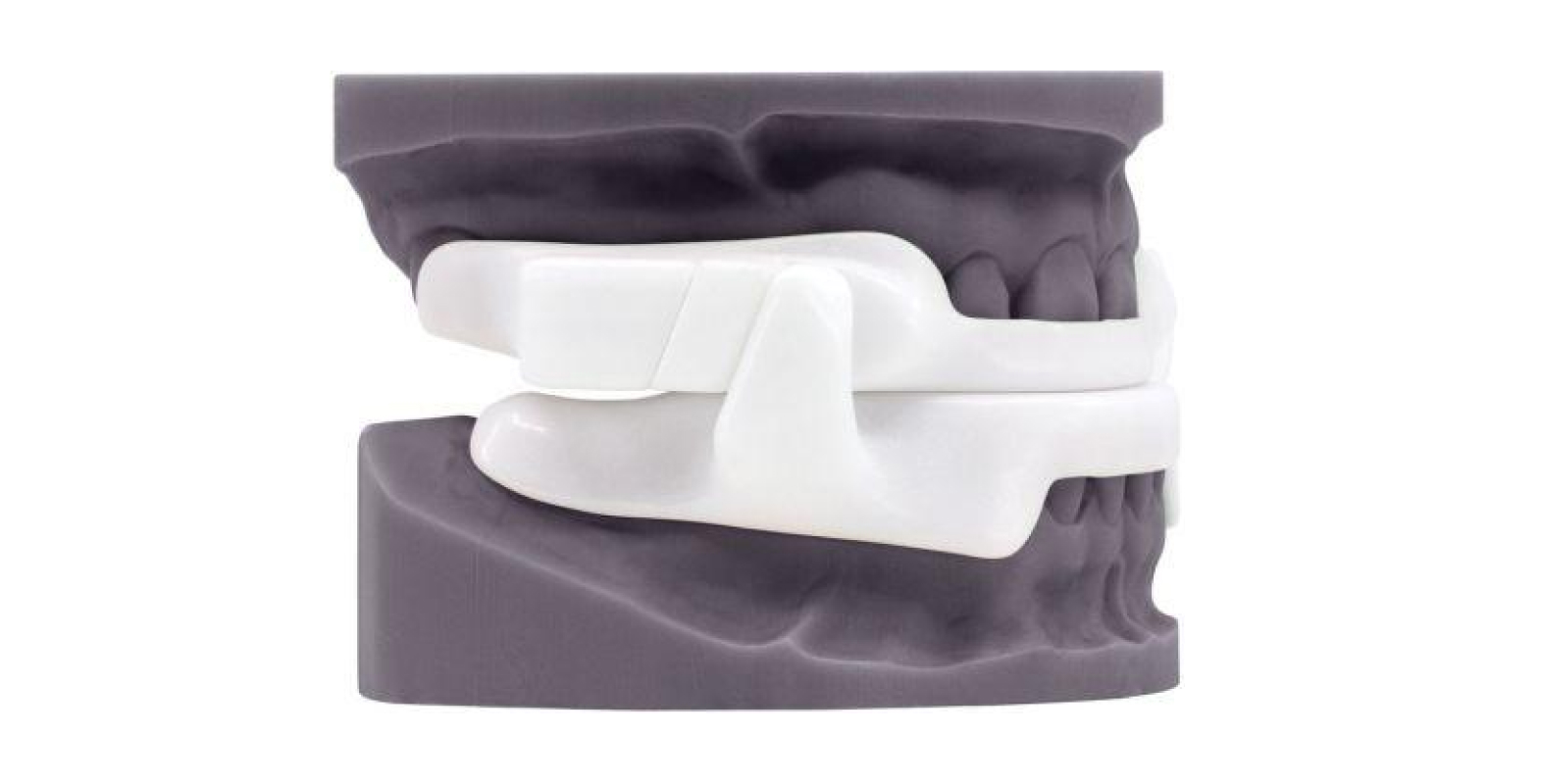 A dental model shows a white mandibular advancement device fitted between upper and lower teeth, demonstrating its use for jaw alignment.